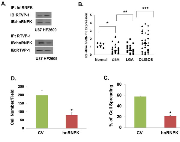 hnRNPK inhibits cell migration and its interaction with RTVP-1 decreases its association with N-WASP.
