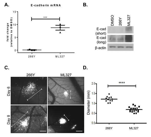 Treatment with ML327 inhibits tumor cell migration