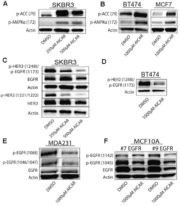 AICAR treatment activates AMPK in breast cancer cell lines.