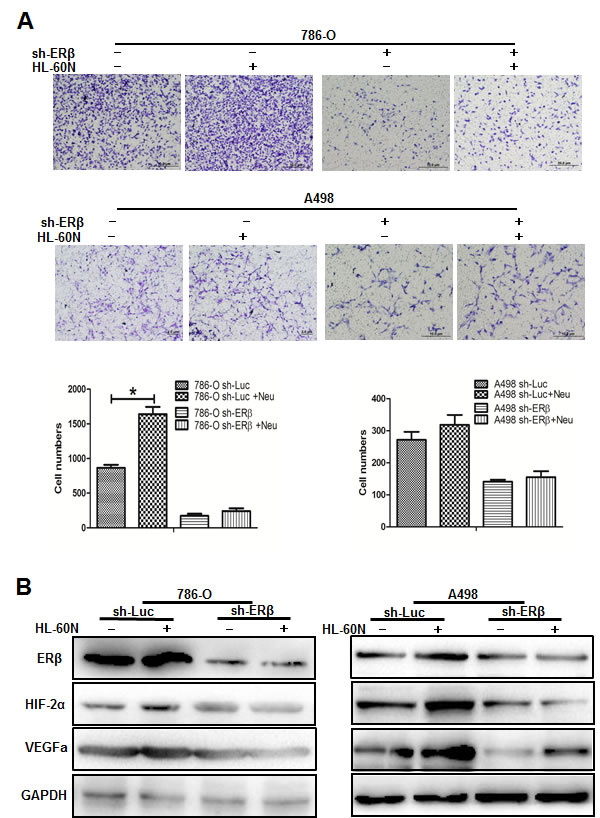 Down-regulated ER&beta; could regulate the down-stream VEGFa and HIF2&alpha; pathways in RCC cells.