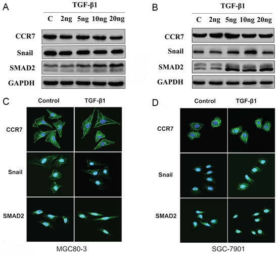 CCR7 contributes to TGF-&#x03B2;1-induced EMT in vitro.