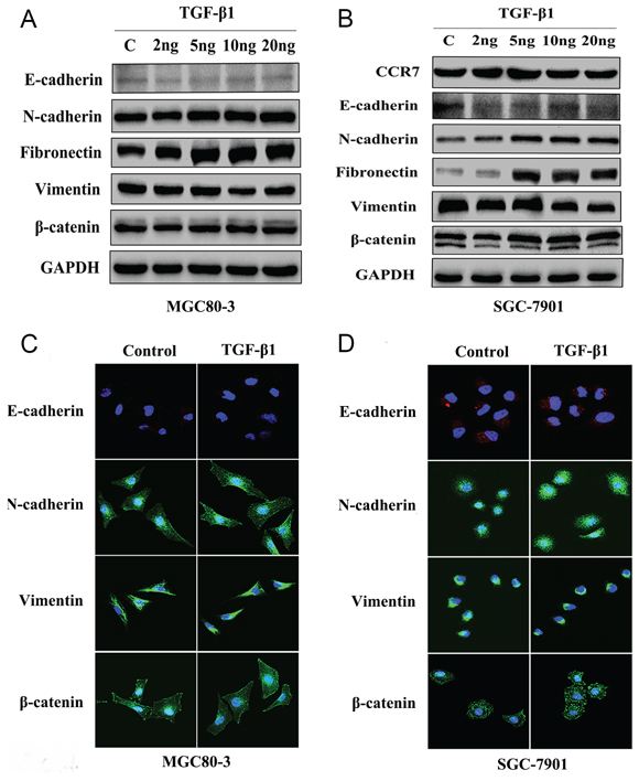 CCR7-low SGC-7901 cells were sensitive to TGF-&#x03B2;1-induced EMT in vitro.
