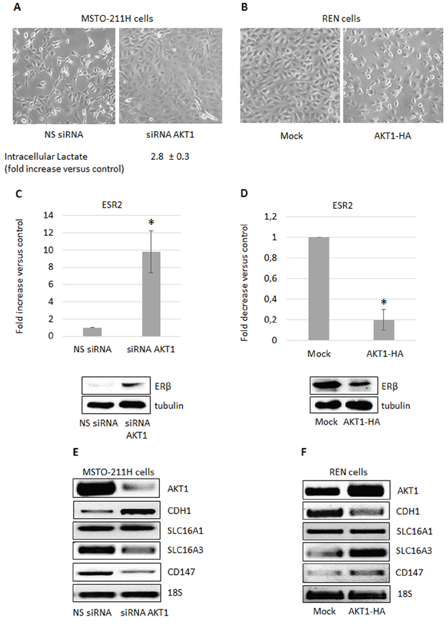 AKT1 modulation in MPM cells affects cell metabolism and ER&#x03B2; expression.