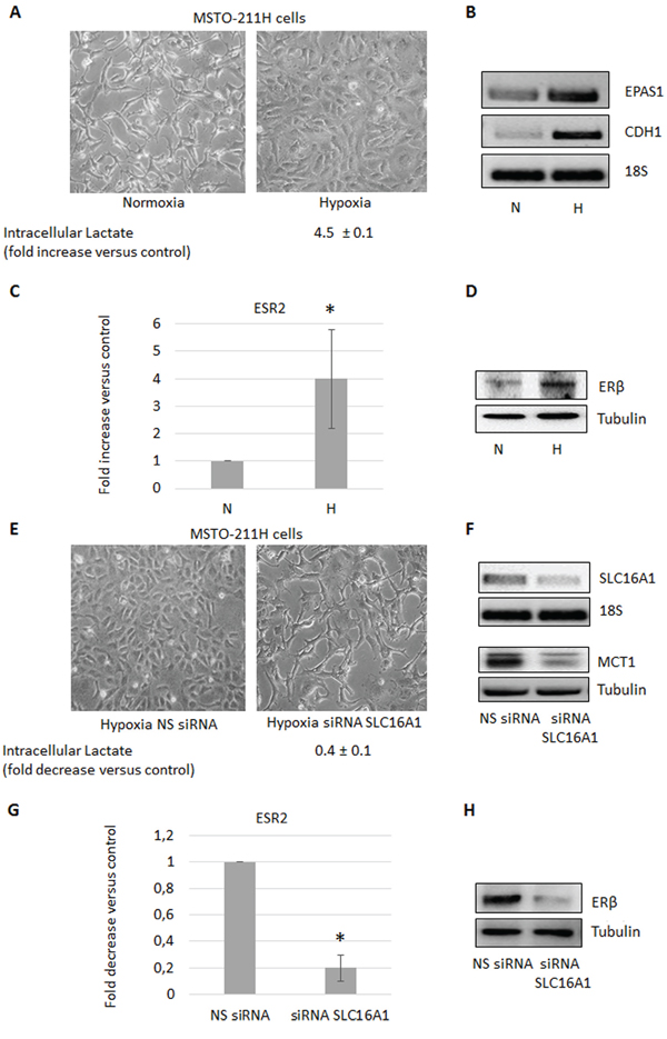 Hypoxia induces the increase of intracellular lactate and ER&#x03B2; expression.