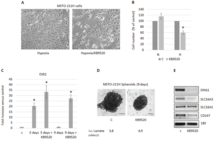 MSTO-211H cells cultured in hypoxic conditions or as spheroids acquire sensitivity to KB9520.