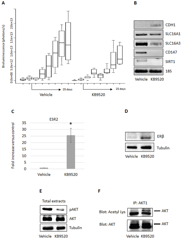 KB9520 sustains ER&#x03B2; expression and reduces tumor growth in vivo.