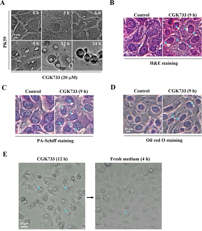 CGK733 induced reversible vesiculation in pancreatic cancer cells.