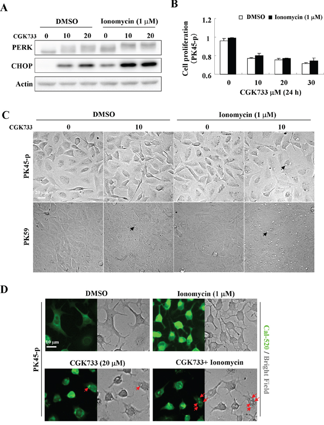 Ionomycin enhanced CGK733-induced PERK/CHOP activation and vesicular calcium sequestration.