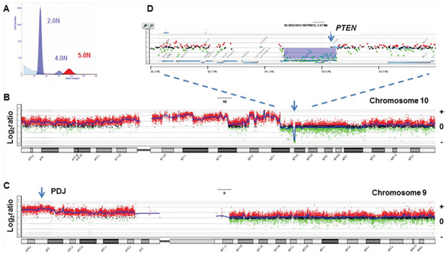 PTEN homozygous deletion in PDJ+ triple negative breast cancer genome.
