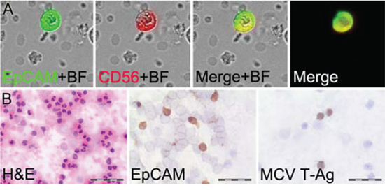 Detection of MCC circulating tumor cells (CTC).