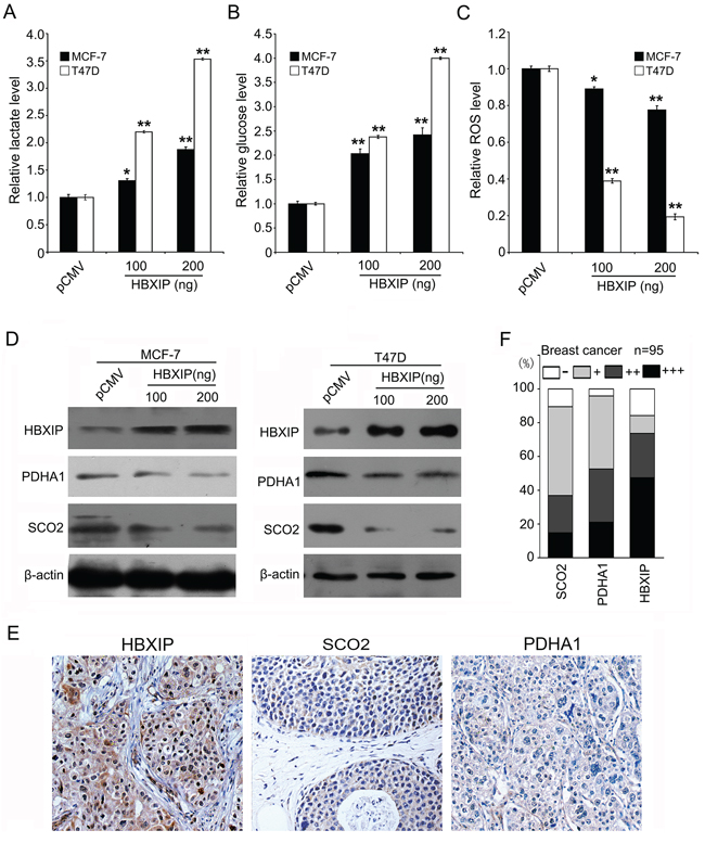 HBXIP regulates glucose metabolism reprogramming and downregulates SCO2 and PDHA1 in breast cancer.
