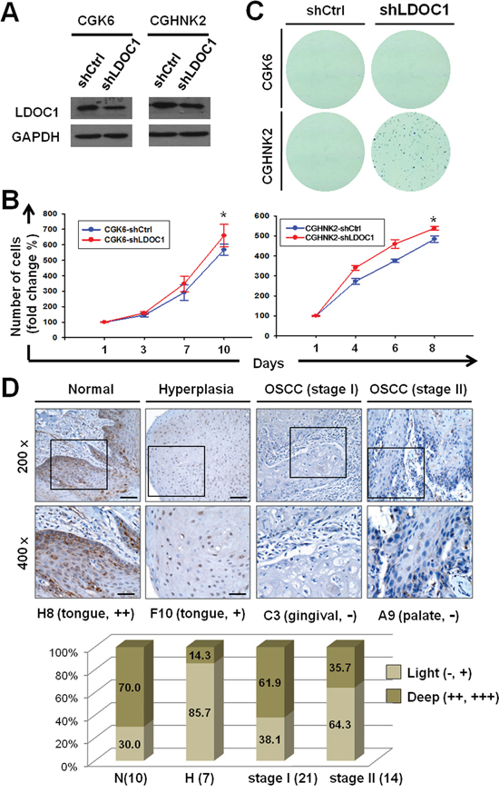 Downregulation of LDOC1 was involved in oral neoplastic transformation.