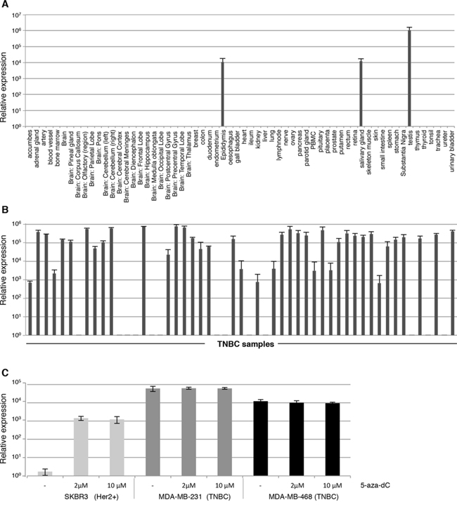 Frequent expression of CXorf61 mRNA in TNBC samples and absence from the vast majority of normal human tissue types.