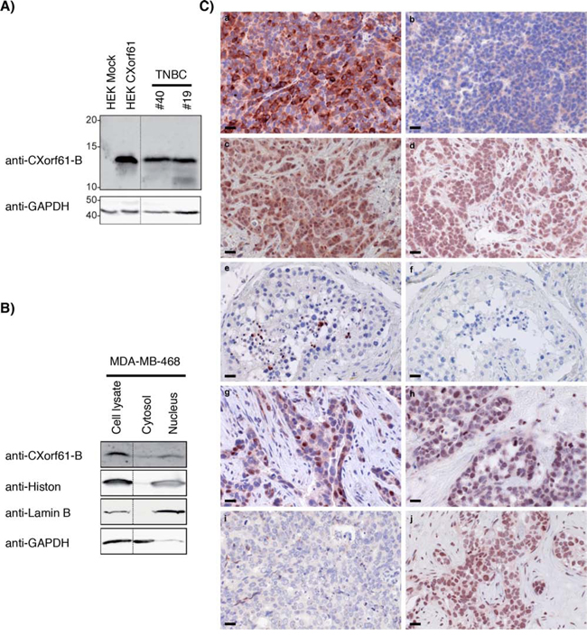 Robust expression of CXorf61 protein in primary TNBC, TNBC cell lines and normal testis.
