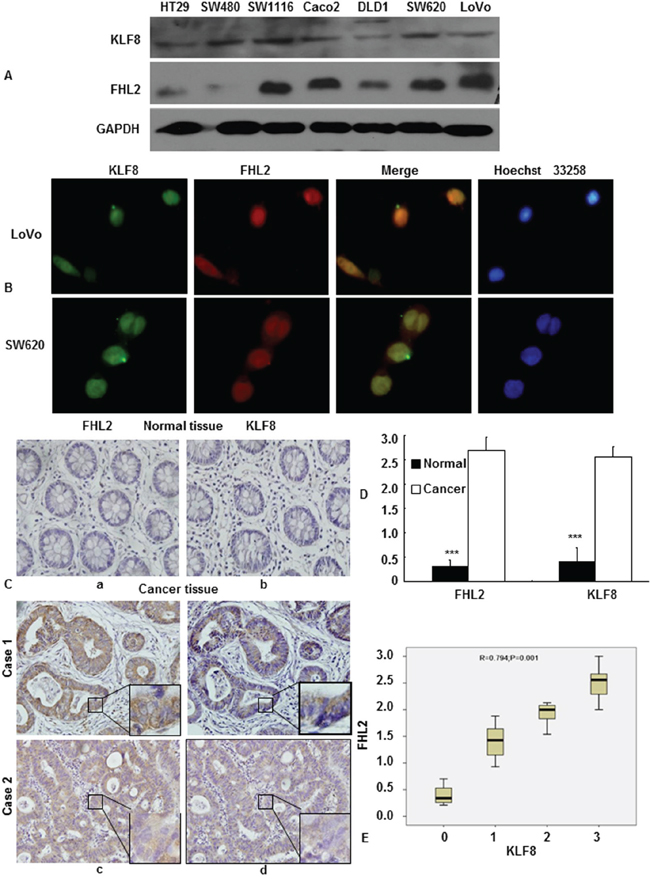 Expression profiles of KLF8 and FHL2 in colon cancer.