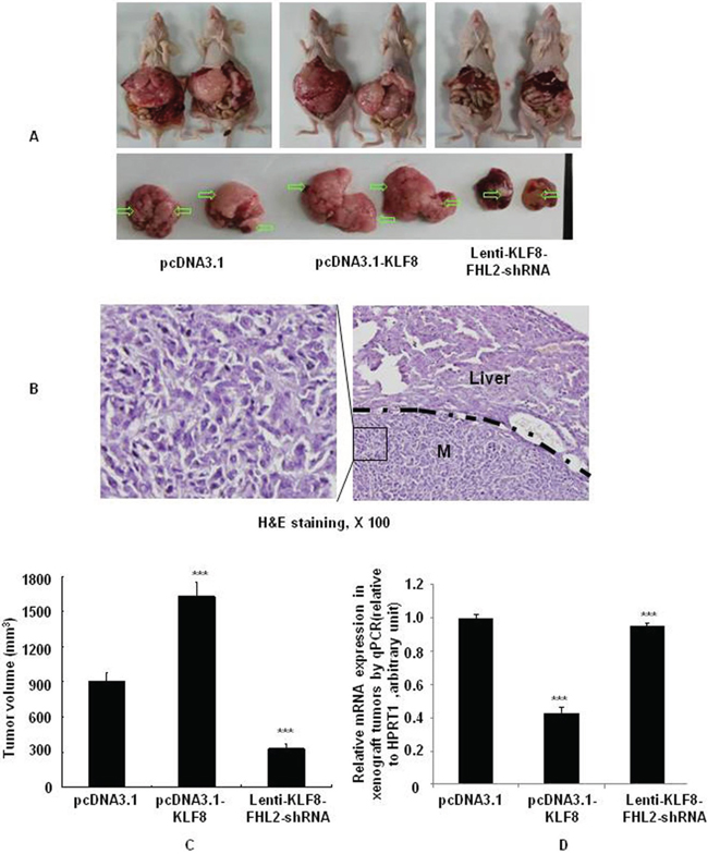 KLF8 is required for FHL2-mediated EMT and liver metastasis in orthotopic tumors after intrasplenic injection.