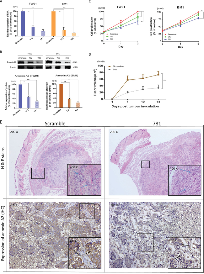 Silencing of annexin A2 (ANXA2) ihibits cell proliferation both in vitro and in vivo.