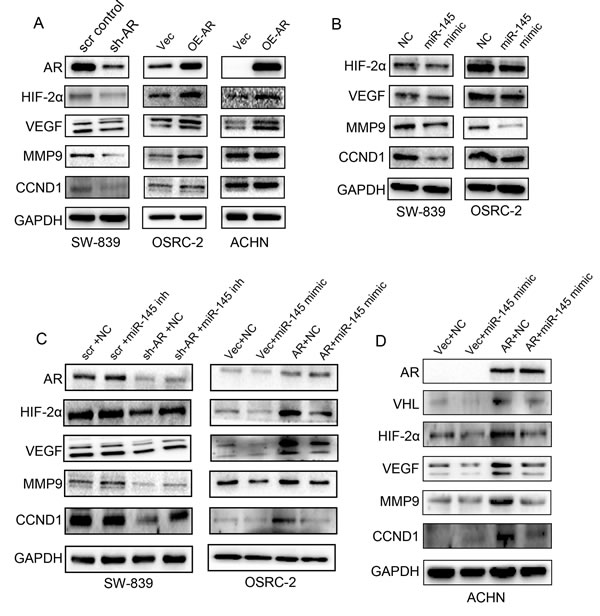 AR regulates the HIF2&#x3b1; expression via miR-145.