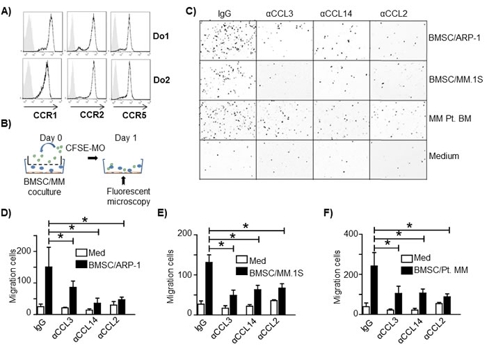 CCL2, CCL3 and CCL14 activate human MO migration to MM tumor bed.
