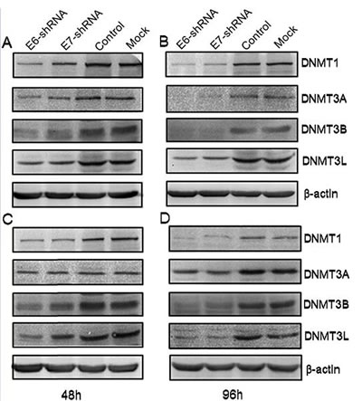 Effect of shRNA-mediated repression of HPV16 E6 and E7 on DNA methyltransferase expression.