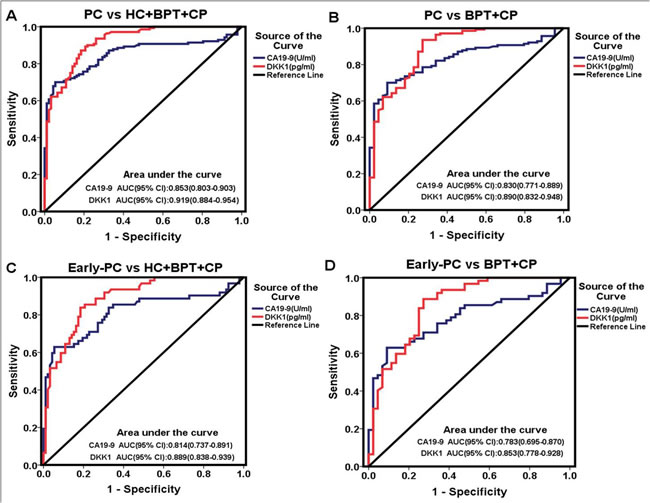 Diagnostic outcomes of pre-operative serological levels of DKK1 (red line) and CA19-9 (blue line) in the diagnosis of PC and early-PC.