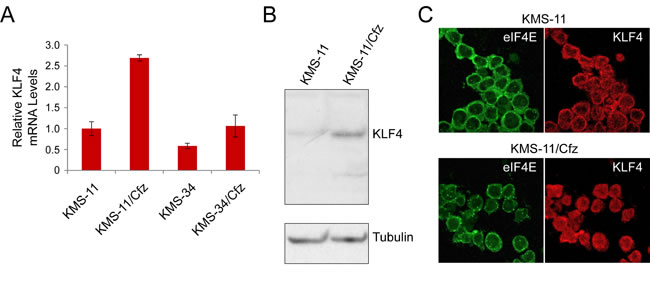 KLF4 expression in KMS-11 and carfilzomib-resistant KMS-11/Cfz cells.