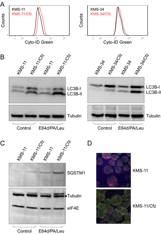 Autophagy is induced in carfilzomib-resistant KMS-11/Cfz and KMS-34/Cfz cells.