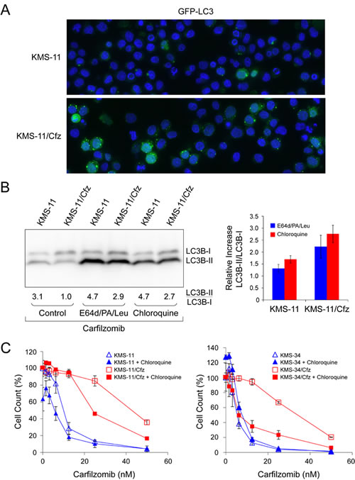 Prosurvival autophagy induction in carfilzomib-resistant MM cells is antagonized by lysosomal inhibitors and chloroquine.