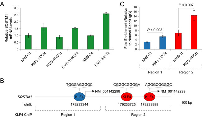 SQSTM1 is a direct target of KLF4 upregulated in carfilzomib-resistant KMS-11/Cfz and KMS-34/Cfz cells.