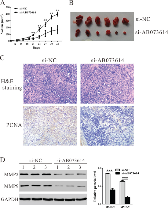 Knockdown AB073614 inhibits OC cells proliferation in vivo.