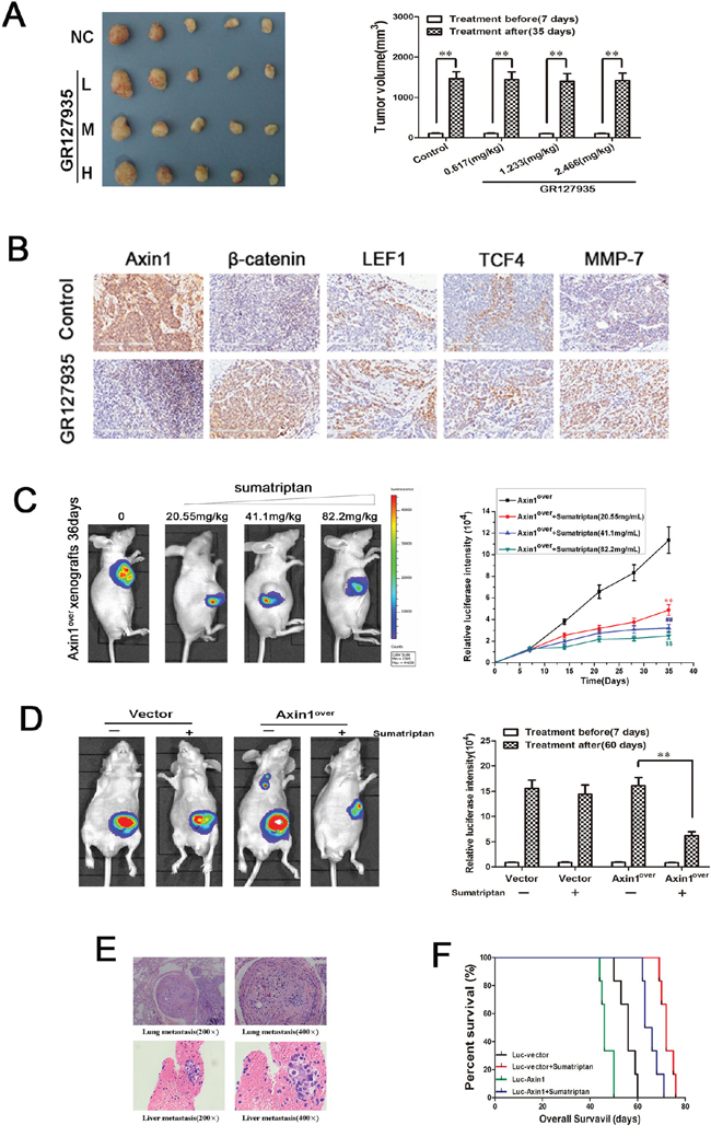 5-HT1DR modulated colorectal cancer invasion/migration in vivo.