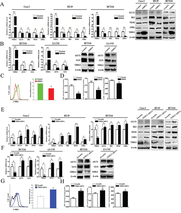 NDRG2 inhibits the expression of glucose and glutamine transporters, glycolytic and glutaminolytic enzymes in colorectal cancer cells.