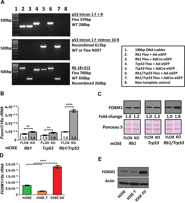 FOXM1 expression in murine and human OSE cells following Rb and/or p53 abrogation.