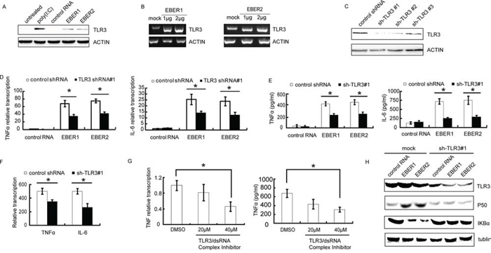EBERs trigger inflammatory response in vitro via TLR3 in NPC cell lines.