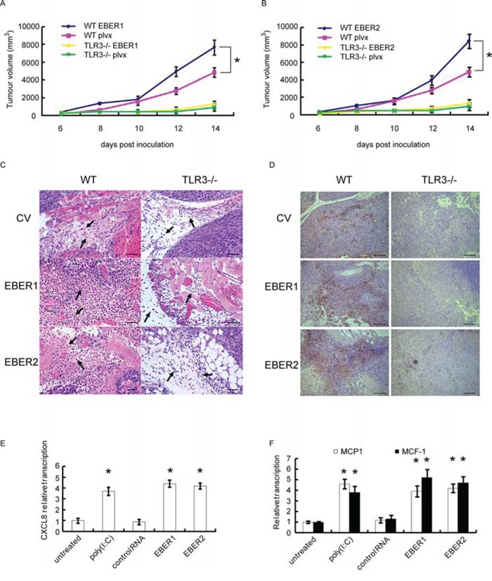 Effect of EBERs-TLR3 on B16 tumor growth and macrophage infiltration.