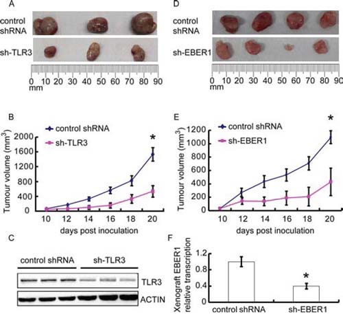 Effect of EBER-induced inflammation via TLR3 on human NPC xenograft growth in vivo.