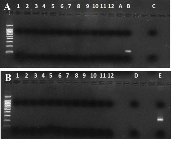 Murine mitochondrial DNA and Intracisternal A Particles long terminal repeats (IAP LTRs) PCR in human saliva.