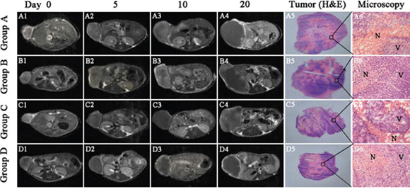 Contrast enhanced T1 (CE-T1) MR images of tumor bearing nude mice from 4 groups at day 0, 5, 10, 20.
