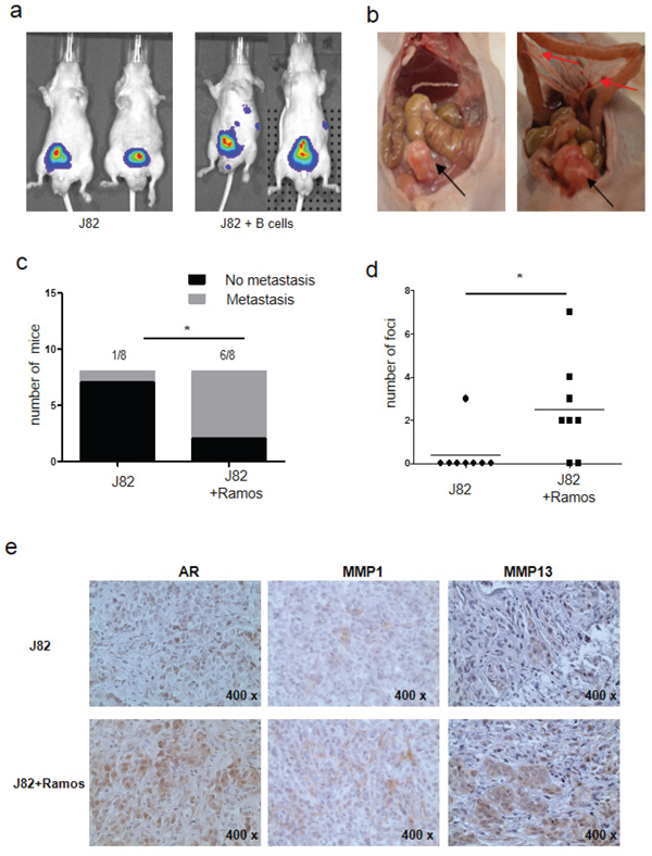B cells promote BCa metastasis using In vivo orthotopic BCa model.
