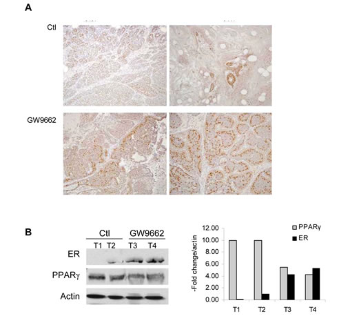 ER expression in adenocarcinomas from control and GW9662 mice.