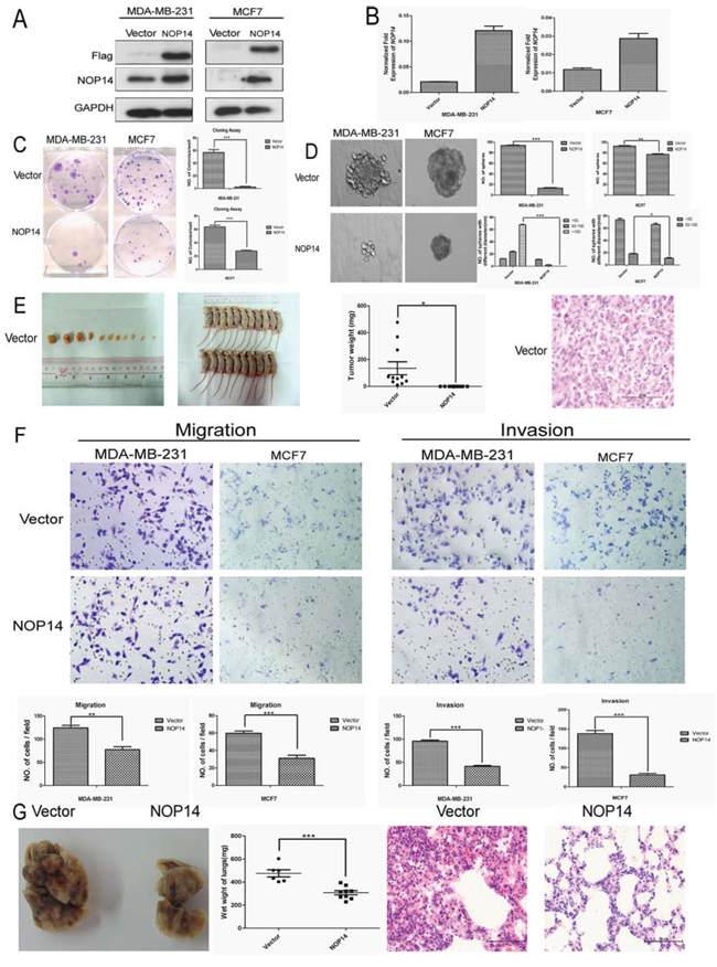 NOP14 overexpression inhibits tumorigenesis and metastasis of breast cancer cells.