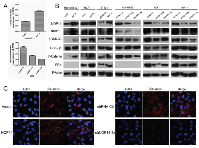 NOP14 inhibits the Wnt/&#x03B2;-catenin pathway.