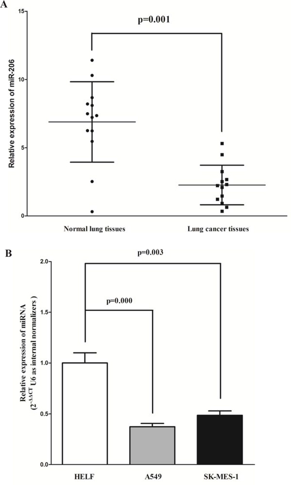 Expression miR-206 is significantly down-regulated in primary human lung cancer.