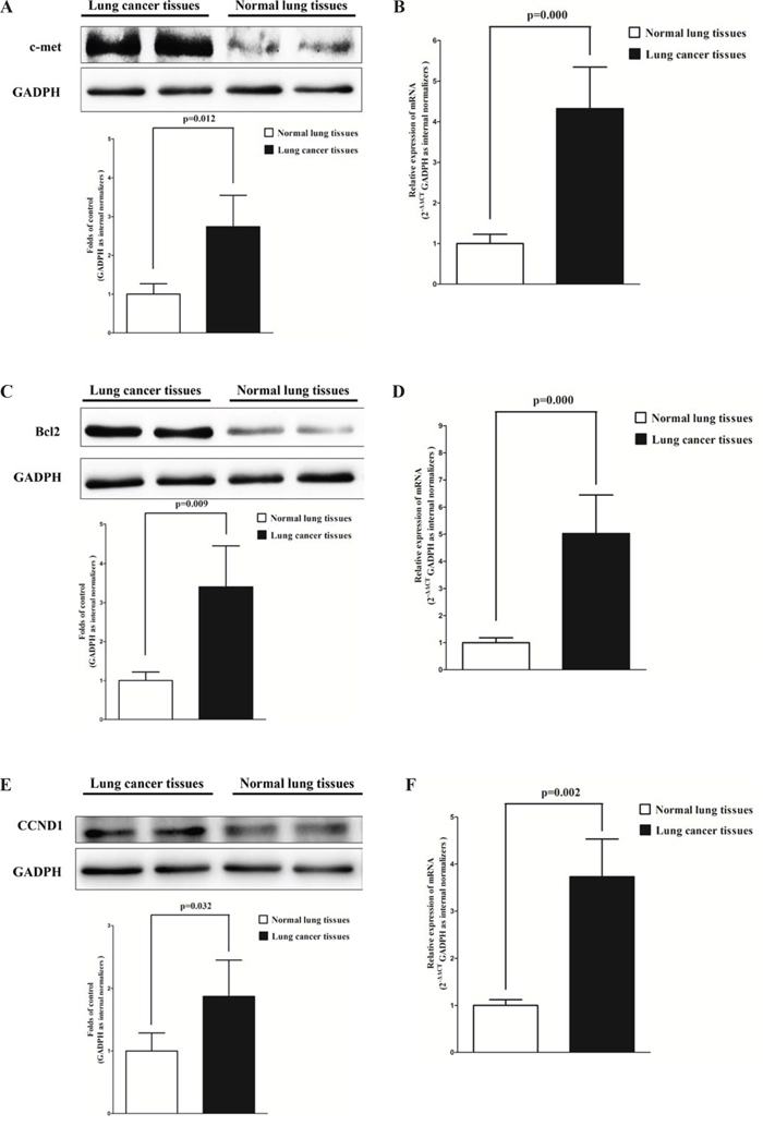 c-Met, Bcl2 and cyclin D1 are up-regulated in primary lung cancer.