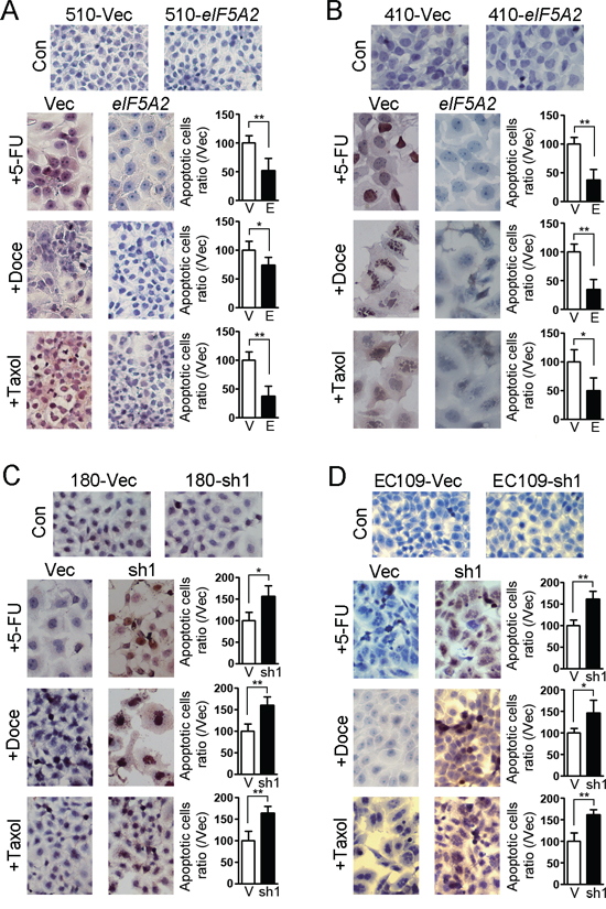 in situ cell death assay showed the effect of EIF5A2 on chemoresistance of ESCC cells.