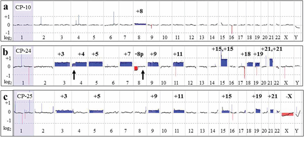 Large chromosomal aberrations detected by aCGH analysis.