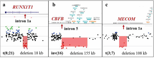Alterations at the breakpoint sites detected by microarray analysis in apparently balanced translocations detected by classical cytogenetic analysis.