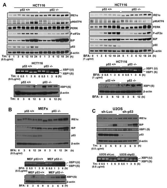 ER stress response in p53-deficient or knockdown cells.