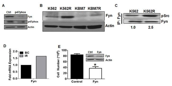 Fyn kinase is downstream of NOX2 in TKI-resistant cells.