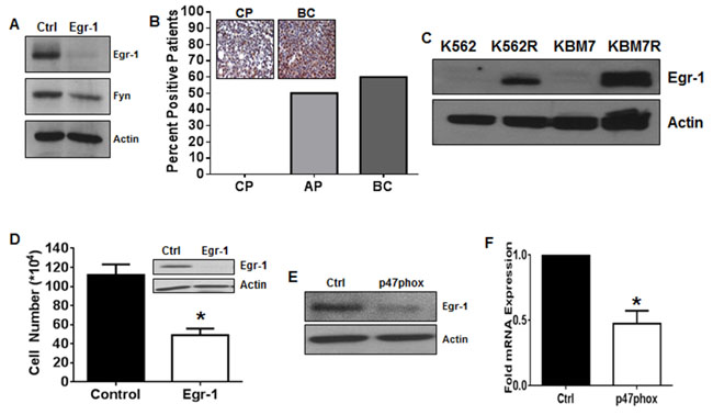 Egr-1 is the transcription factor connecting NOX2 to Fyn in TKI-resistant CML.